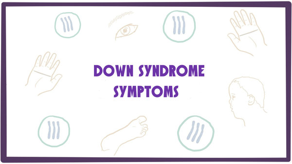 Common symptoms of Down Syndrome